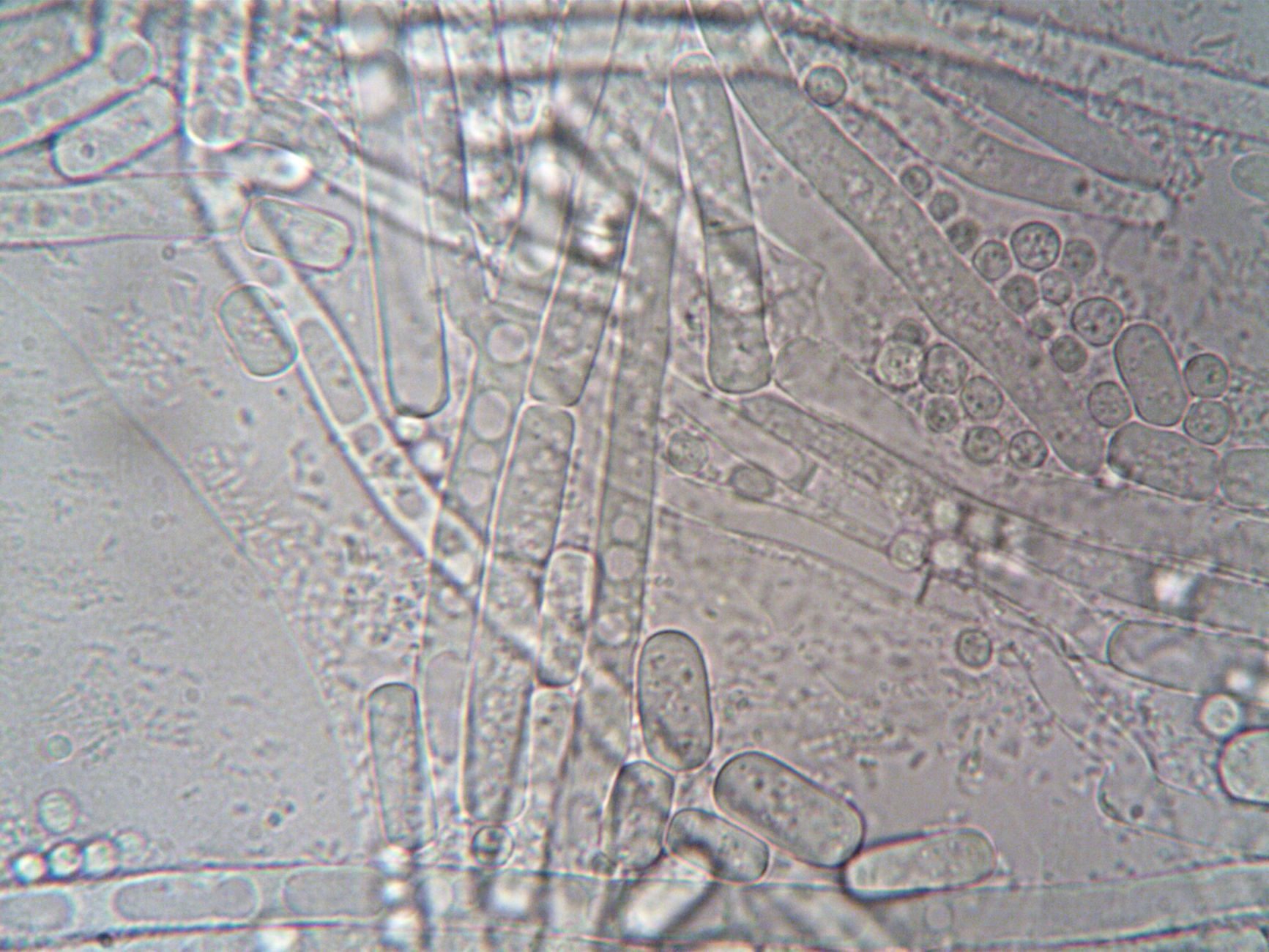 Close-up of fuzzy white mold growth on kombucha surface, showing dry powdery texture distinct from healthy SCOBY