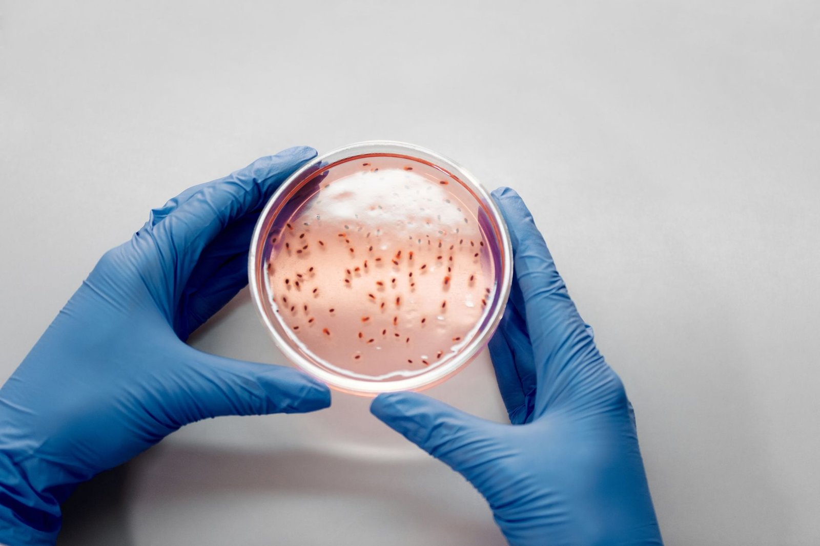 Close-up of a Candida albicans culture in a petri dish under laboratory lighting